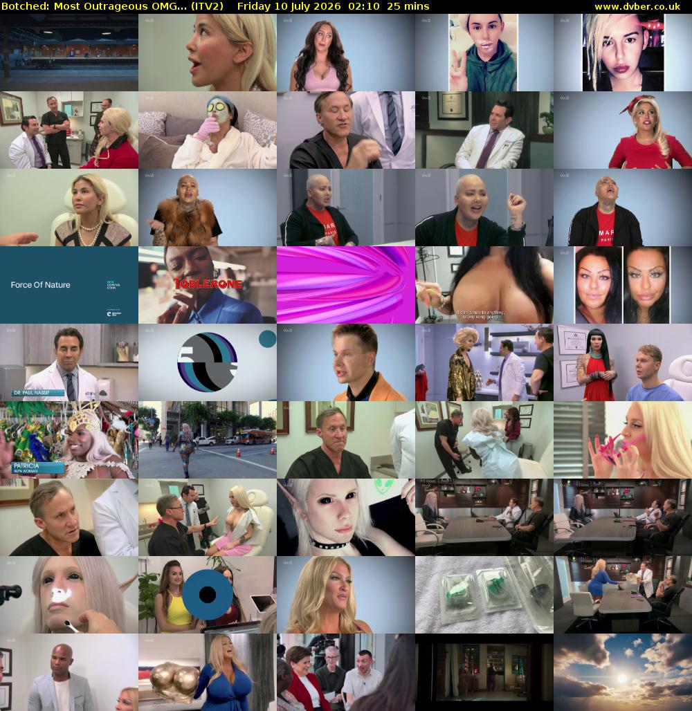 Botched: Most Outrageous OMG... (ITV2) Friday 10 July 2026 02:10 - 02:35