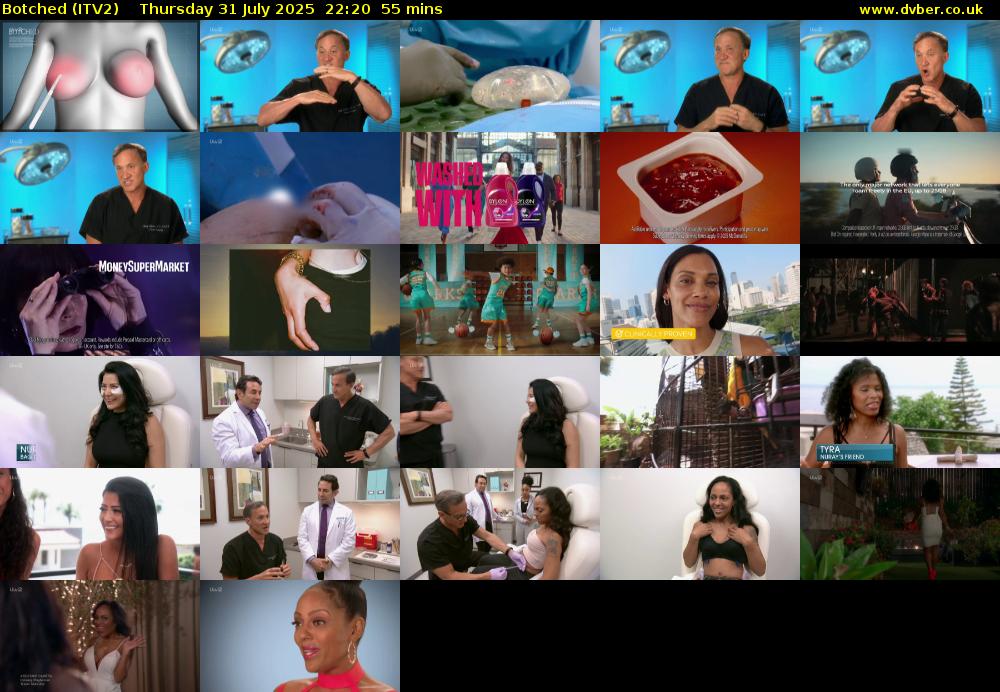 Botched (ITV2) Thursday 31 July 2025 22:20 - 23:15