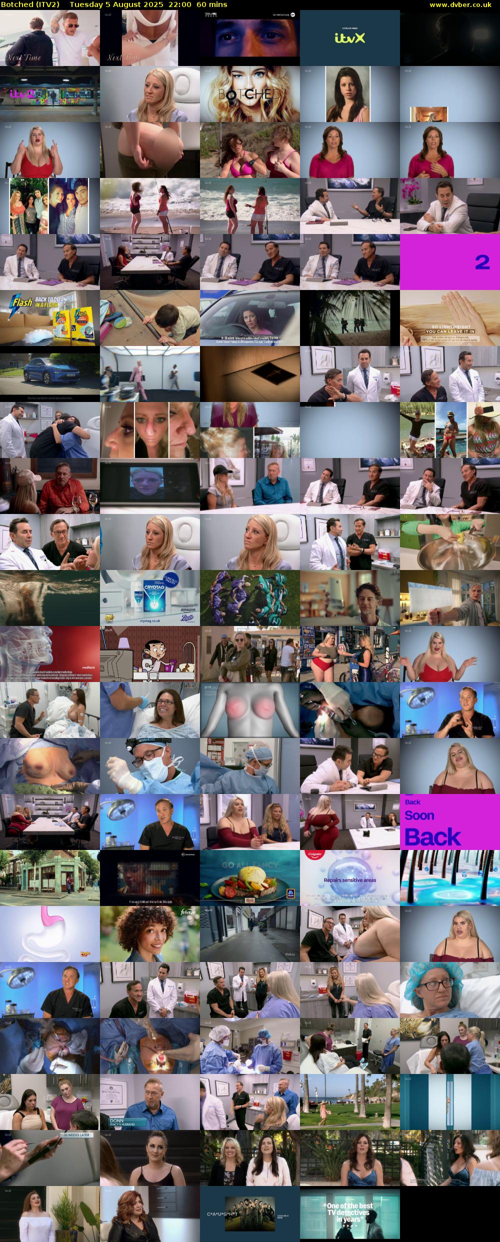 Botched (ITV2) Tuesday 5 August 2025 22:00 - 23:00