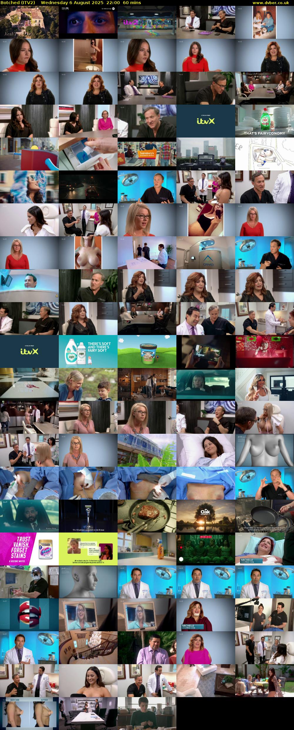 Botched (ITV2) Wednesday 6 August 2025 22:00 - 23:00