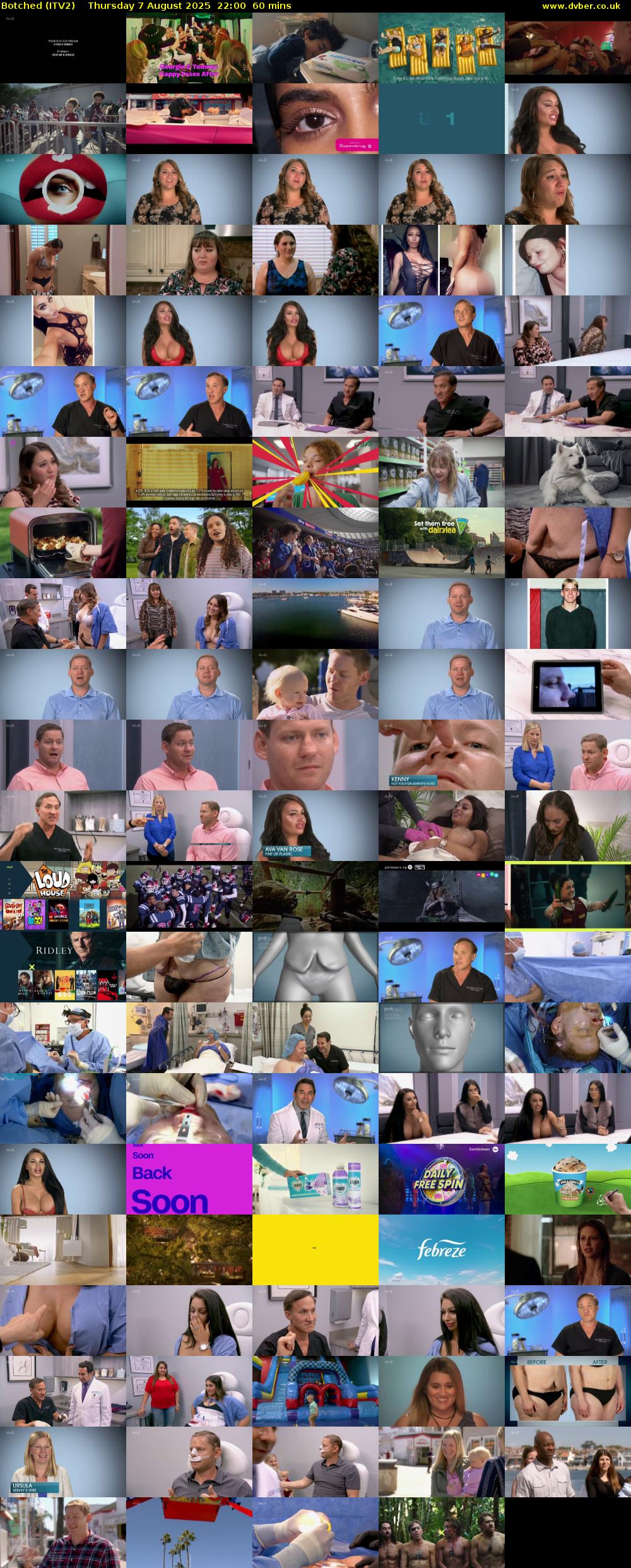 Botched (ITV2) Thursday 7 August 2025 22:00 - 23:00