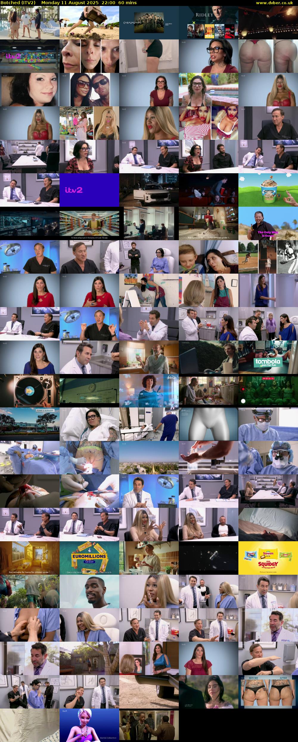 Botched (ITV2) Monday 11 August 2025 22:00 - 23:00