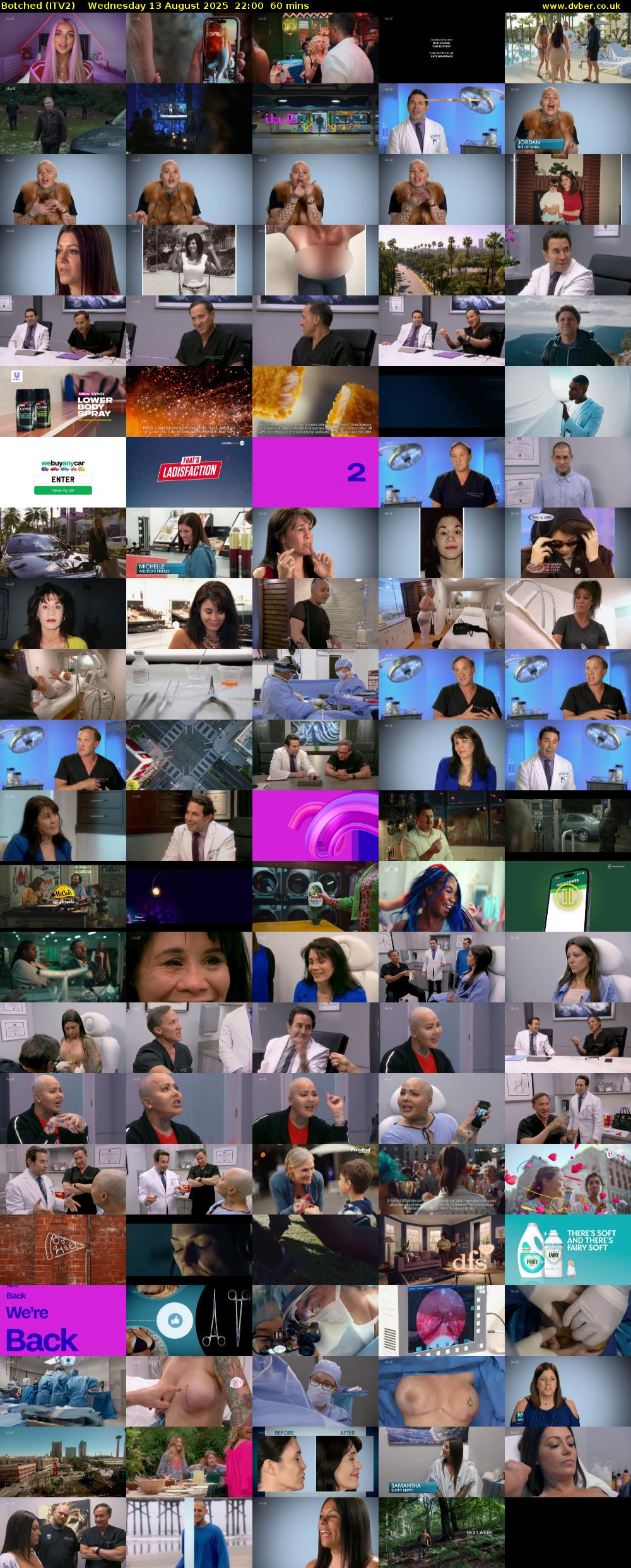 Botched (ITV2) Wednesday 13 August 2025 22:00 - 23:00