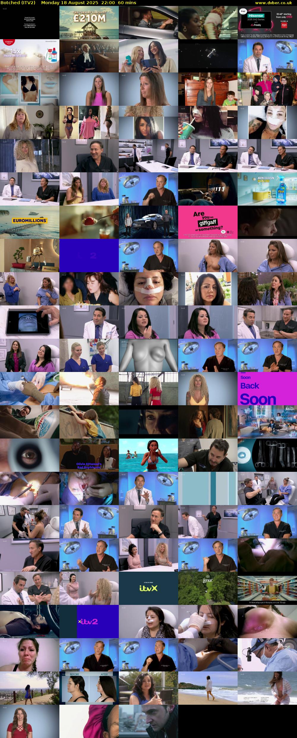 Botched (ITV2) Monday 18 August 2025 22:00 - 23:00