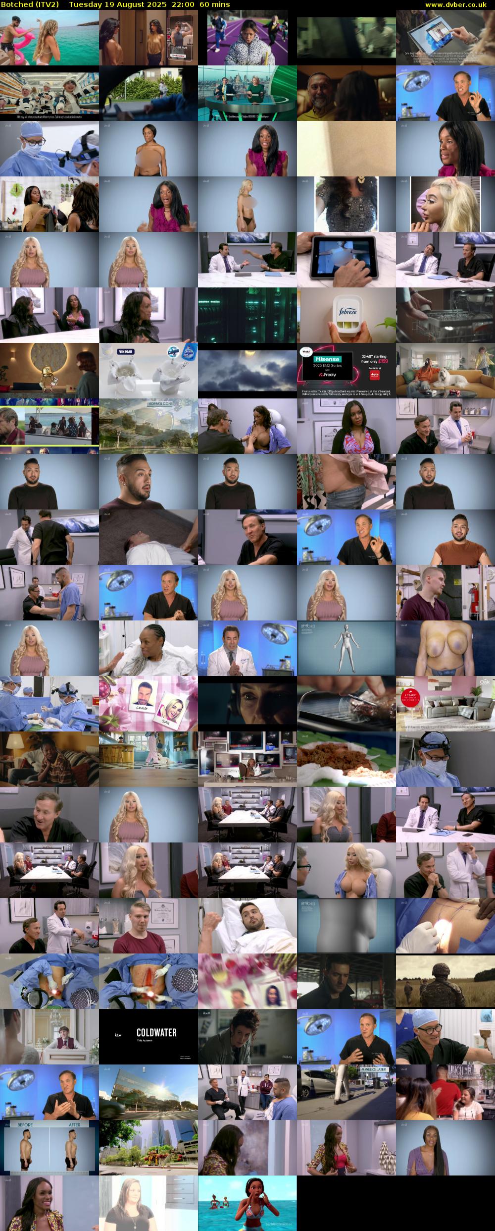 Botched (ITV2) Tuesday 19 August 2025 22:00 - 23:00