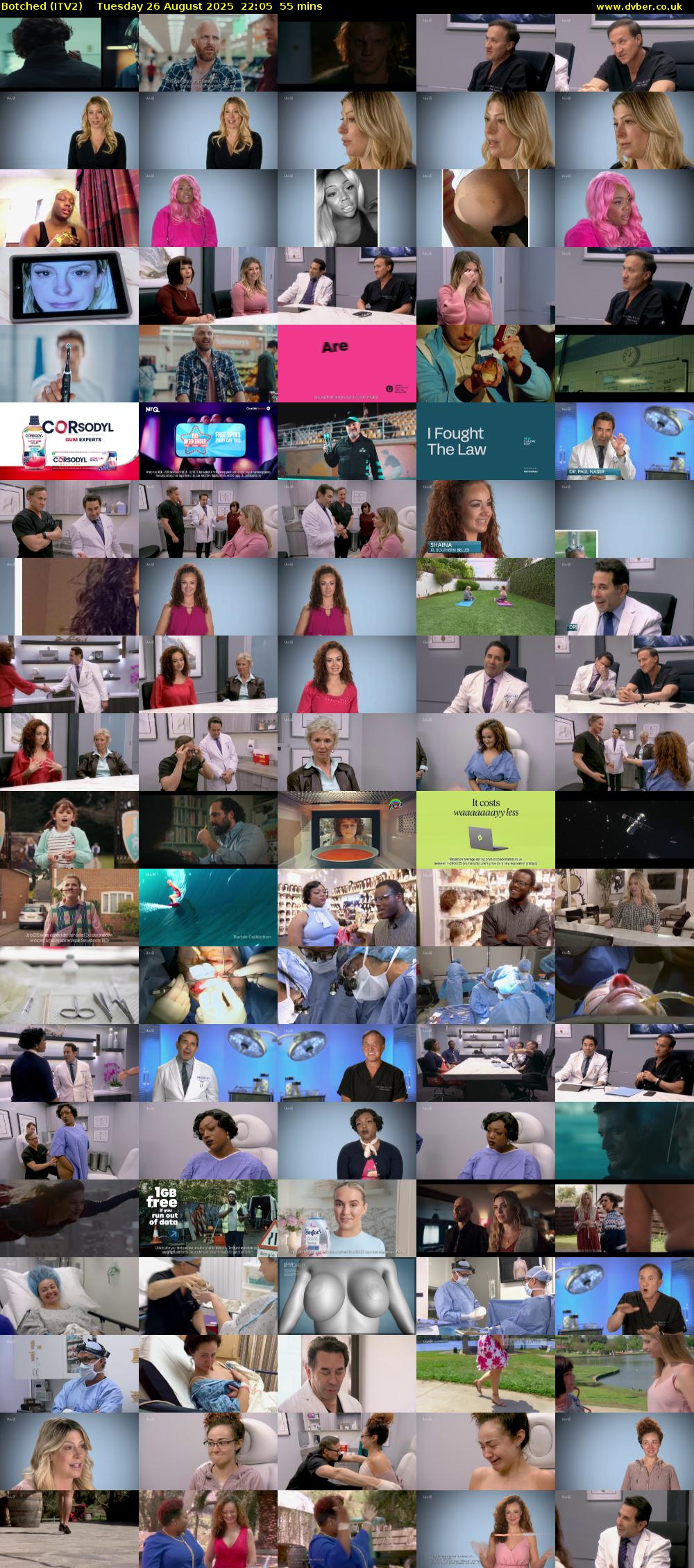 Botched (ITV2) Tuesday 26 August 2025 22:05 - 23:00