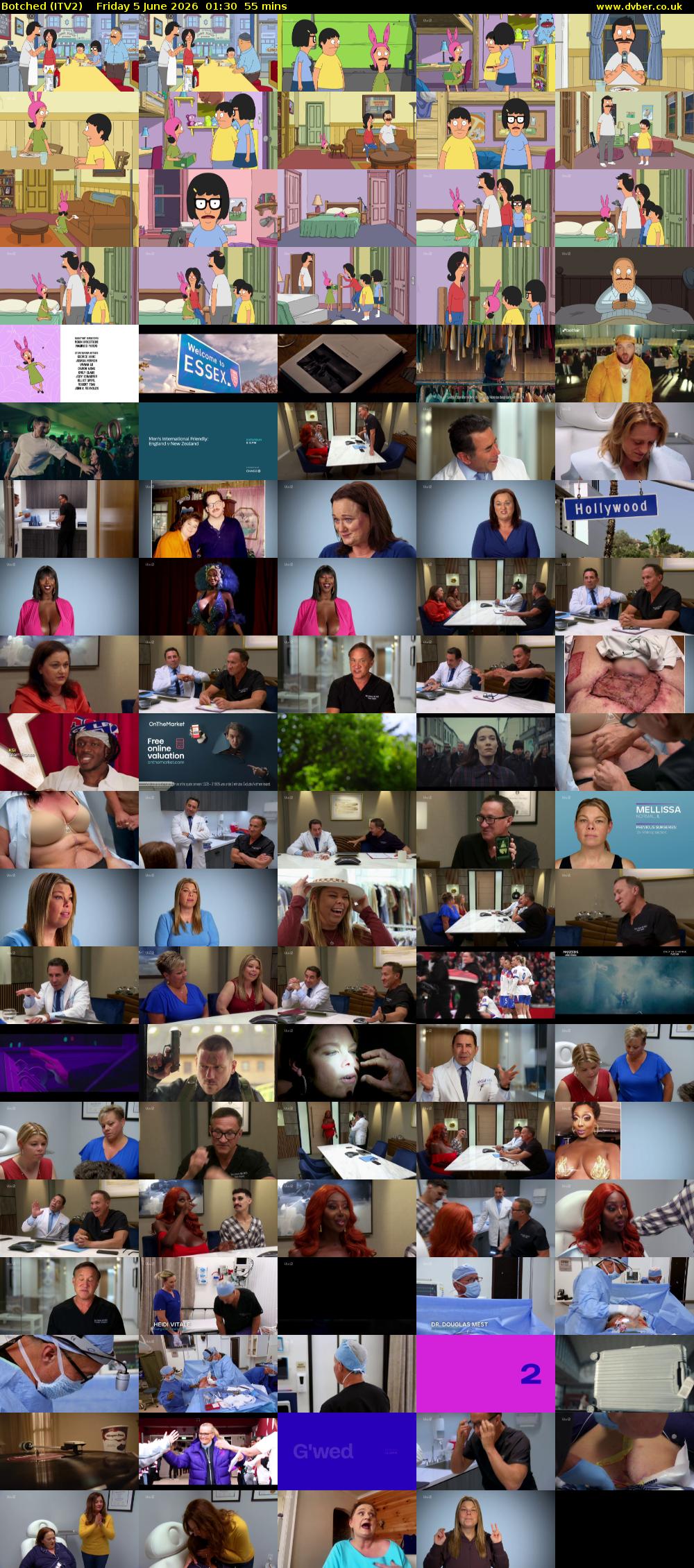 Botched (ITV2) Friday 5 June 2026 01:30 - 02:25