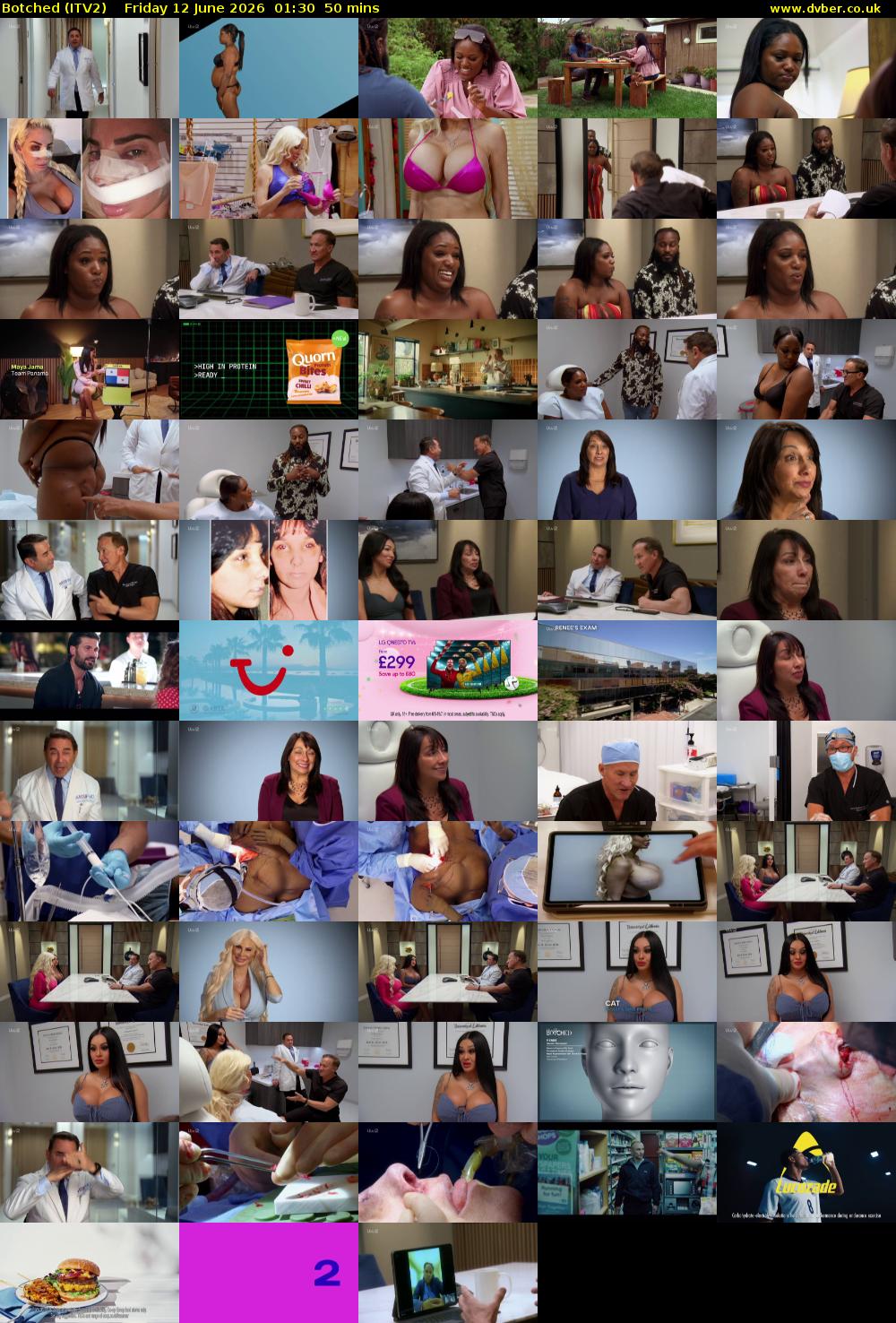 Botched (ITV2) Friday 12 June 2026 01:30 - 02:20