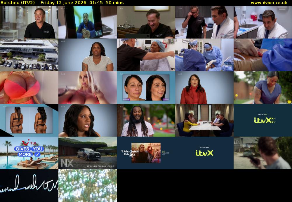 Botched (ITV2) Friday 12 June 2026 01:45 - 02:35