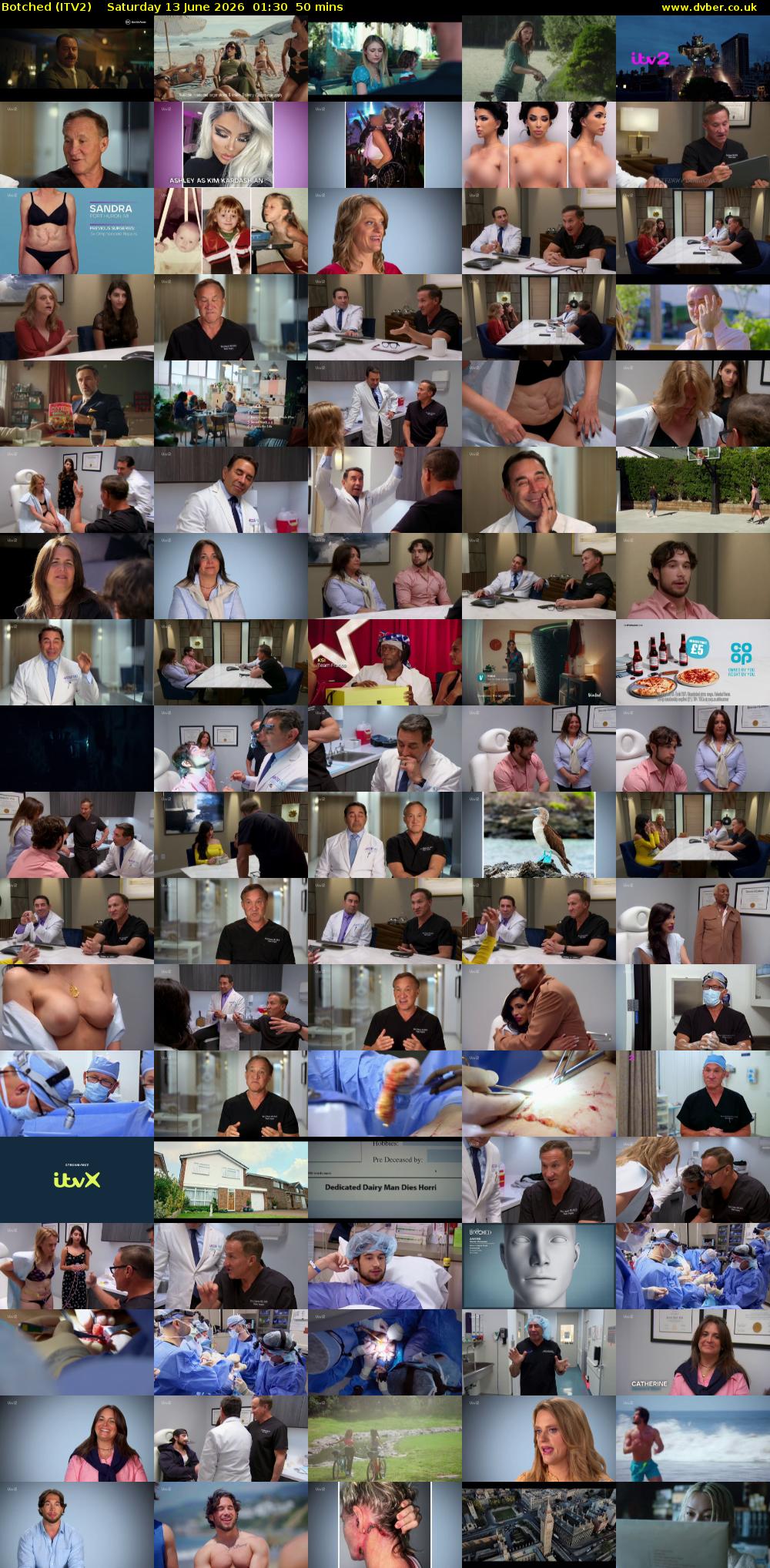 Botched (ITV2) Saturday 13 June 2026 01:30 - 02:20