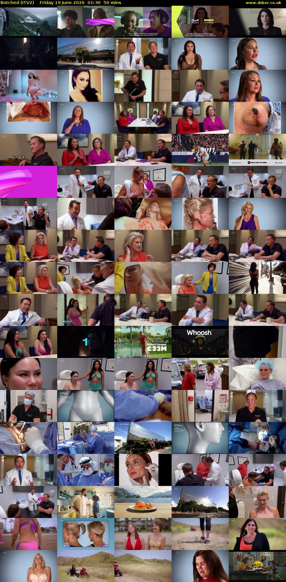 Botched (ITV2) Friday 19 June 2026 01:30 - 02:20