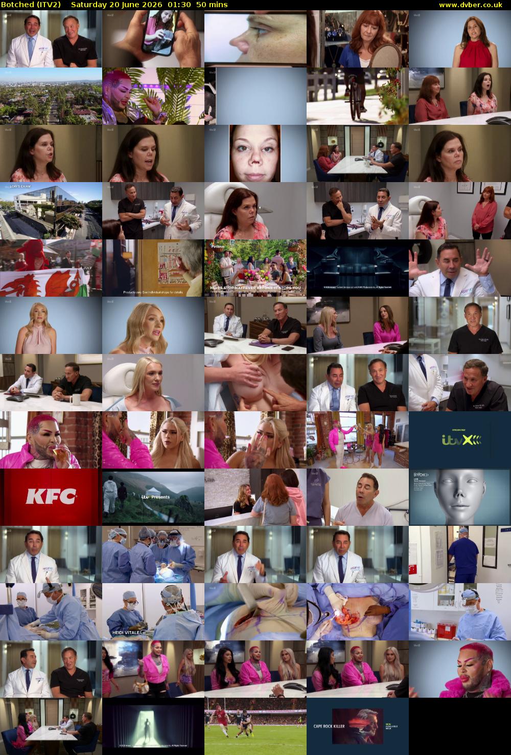 Botched (ITV2) Saturday 20 June 2026 01:30 - 02:20