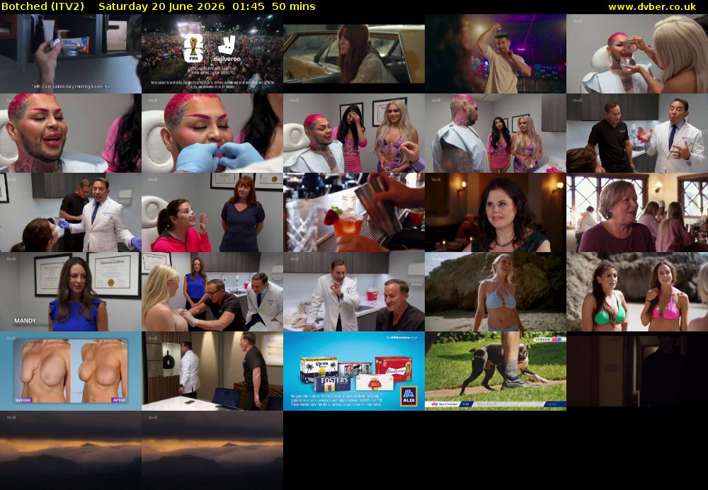 Botched (ITV2) Saturday 20 June 2026 01:45 - 02:35