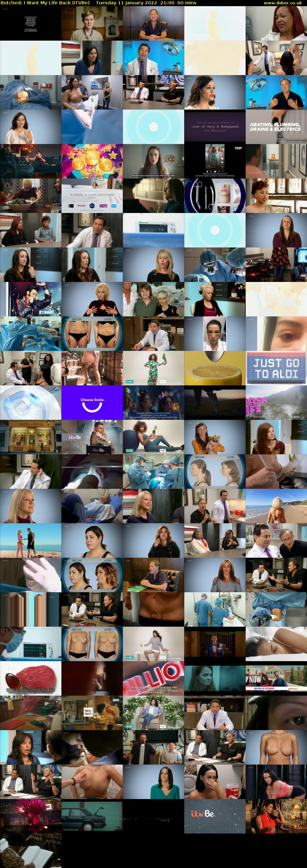 Botched: I Want My Life Back (ITVBe) Tuesday 11 January 2022 21:00 - 22:00