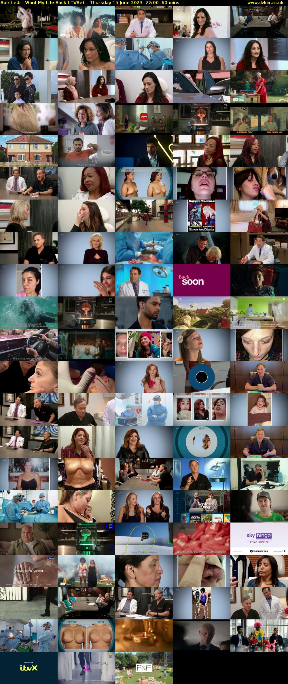 Botched: I Want My Life Back (ITVBe) Thursday 15 June 2023 22:00 - 23:00