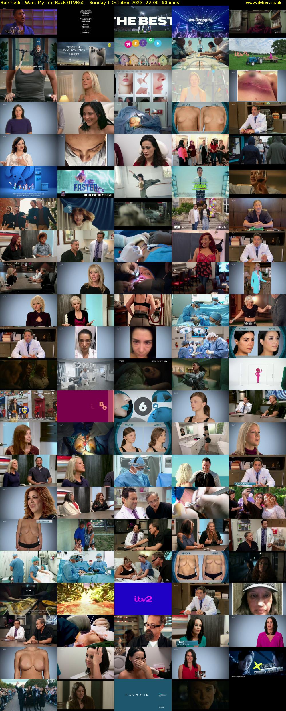 Botched: I Want My Life Back (ITVBe) Sunday 1 October 2023 22:00 - 23:00