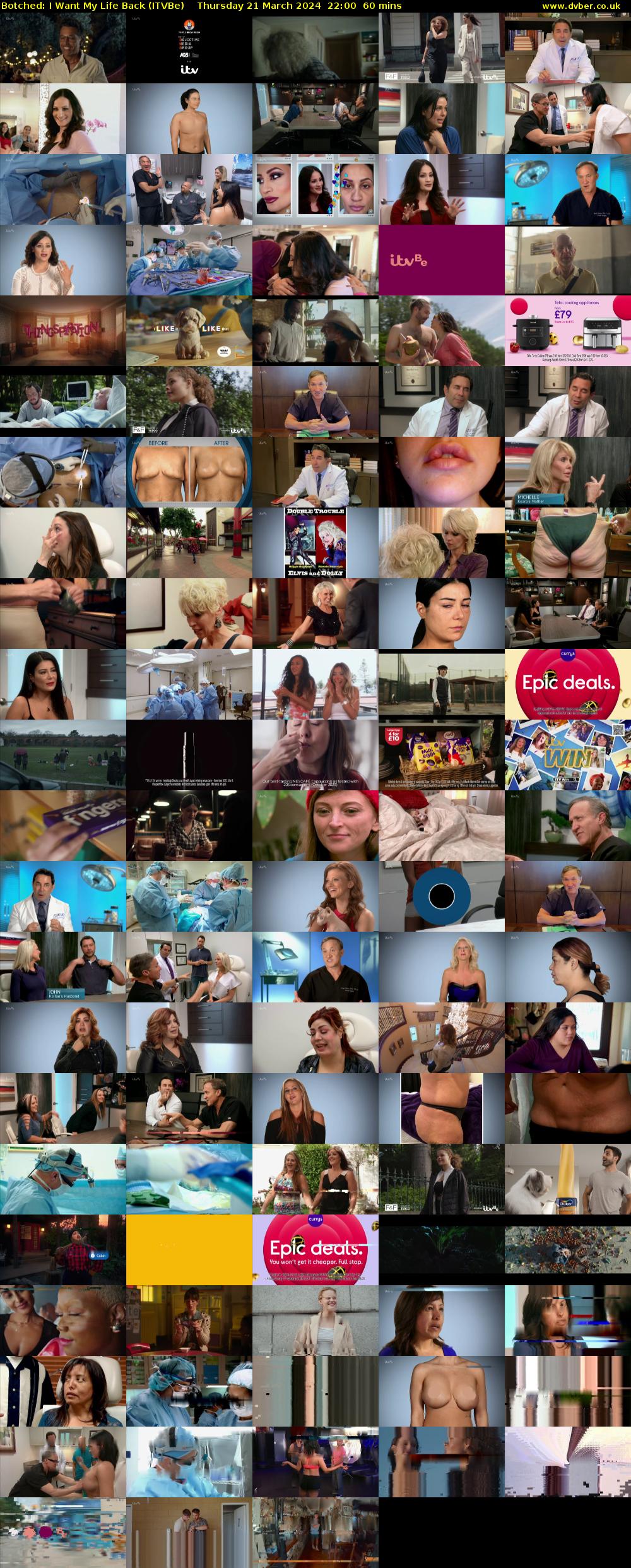 Botched: I Want My Life Back (ITVBe) Thursday 21 March 2024 22:00 - 23:00