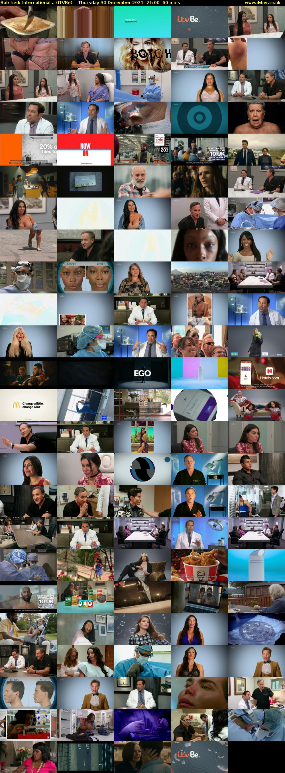Botched: International... (ITVBe) Thursday 30 December 2021 21:00 - 22:00