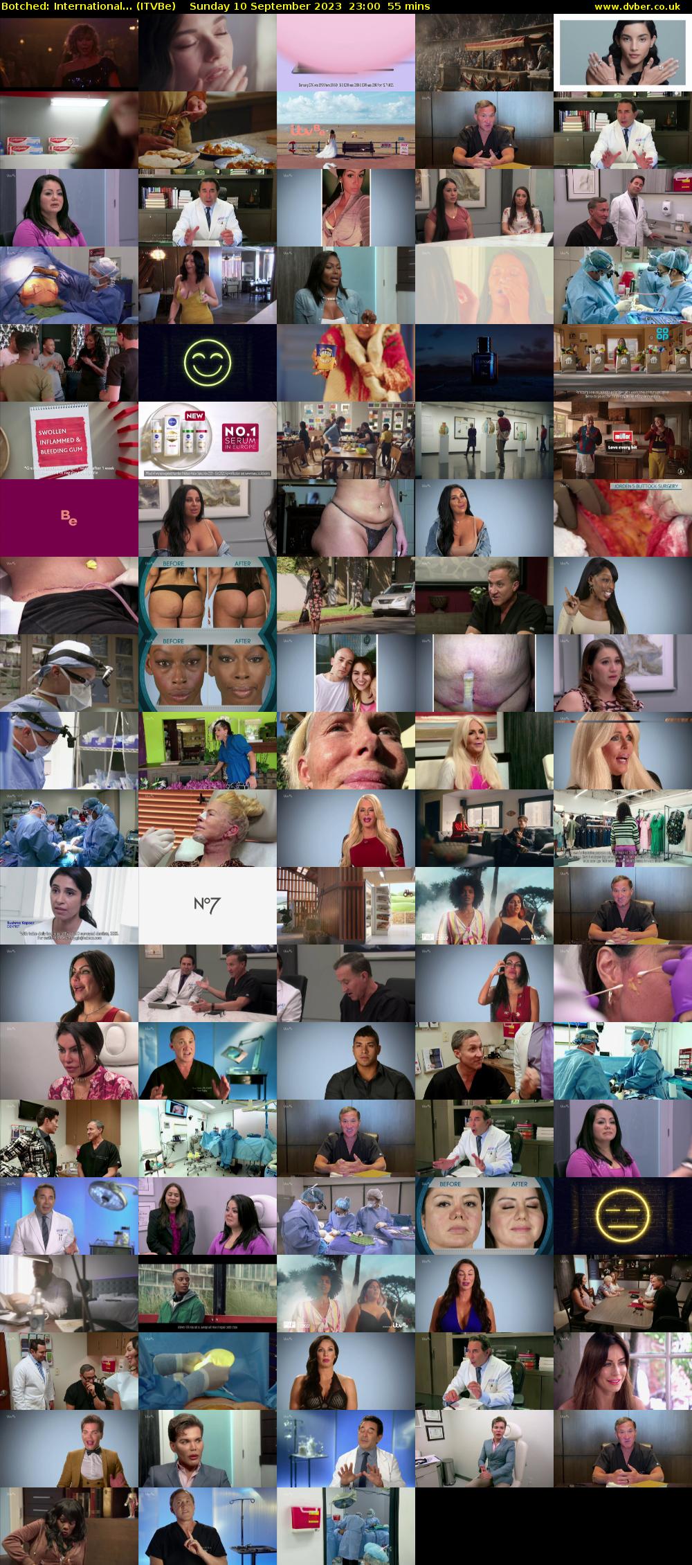 Botched: International... (ITVBe) Sunday 10 September 2023 23:00 - 23:55