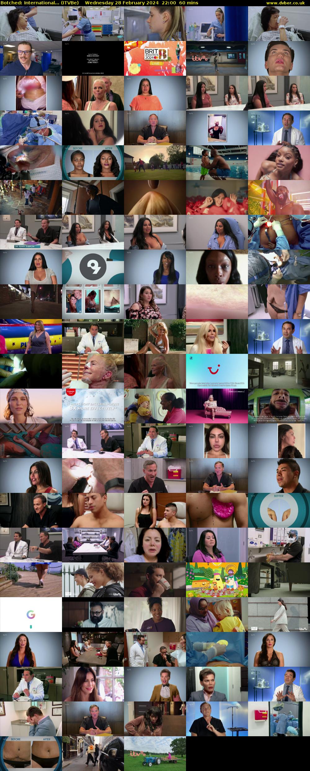 Botched: International... (ITVBe) Wednesday 28 February 2024 22:00 - 23:00