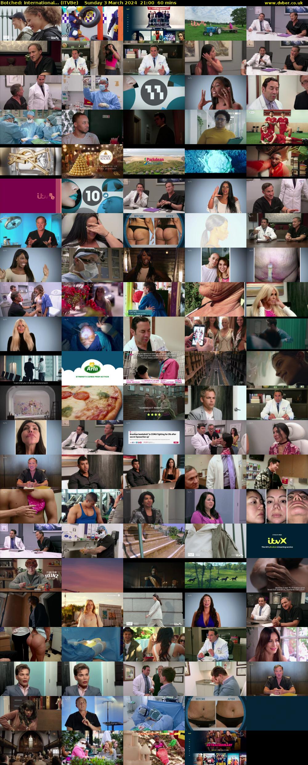 Botched: International... (ITVBe) Sunday 3 March 2024 21:00 - 22:00