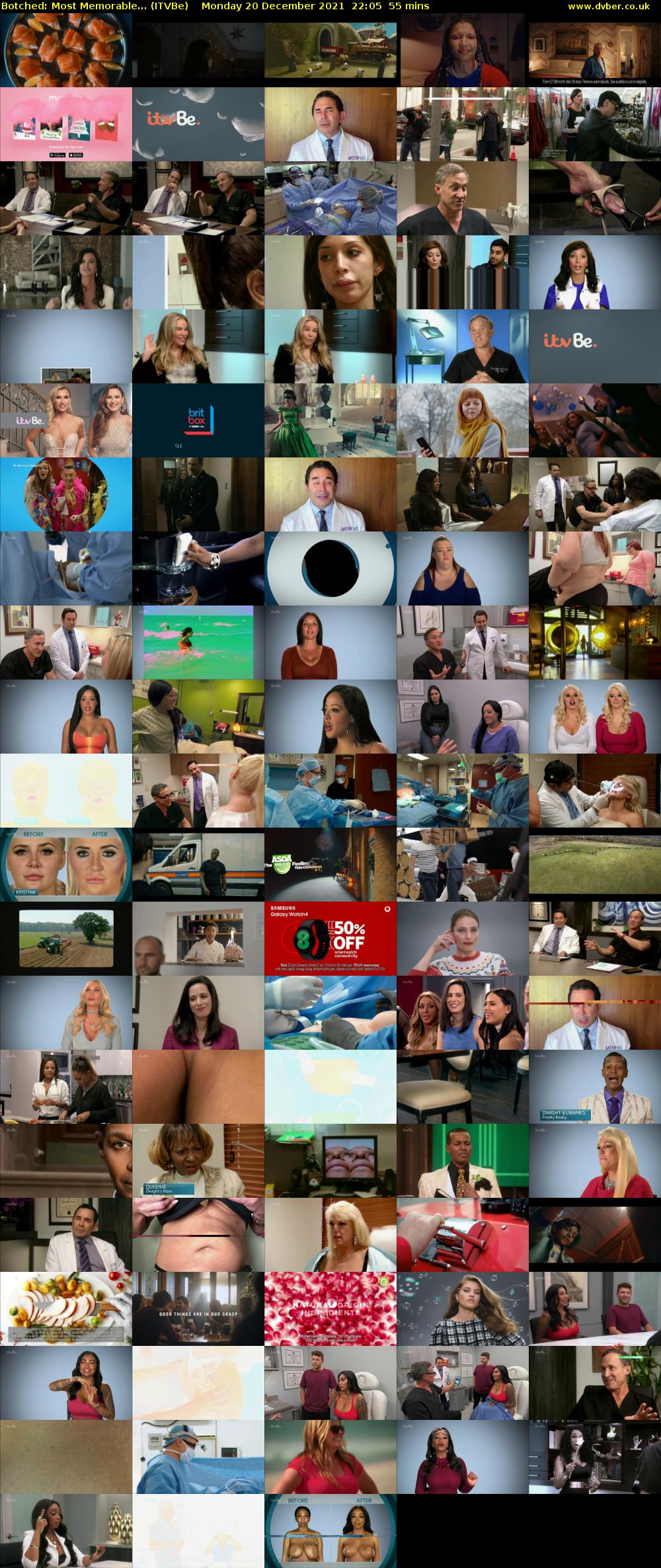 Botched: Most Memorable... (ITVBe) Monday 20 December 2021 22:05 - 23:00