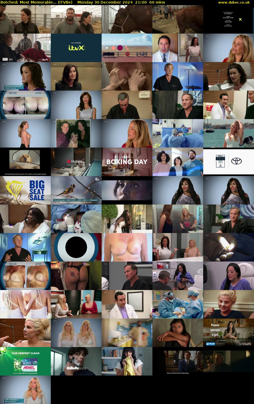 Botched: Most Memorable... (ITVBe) Monday 30 December 2024 21:00 - 22:00