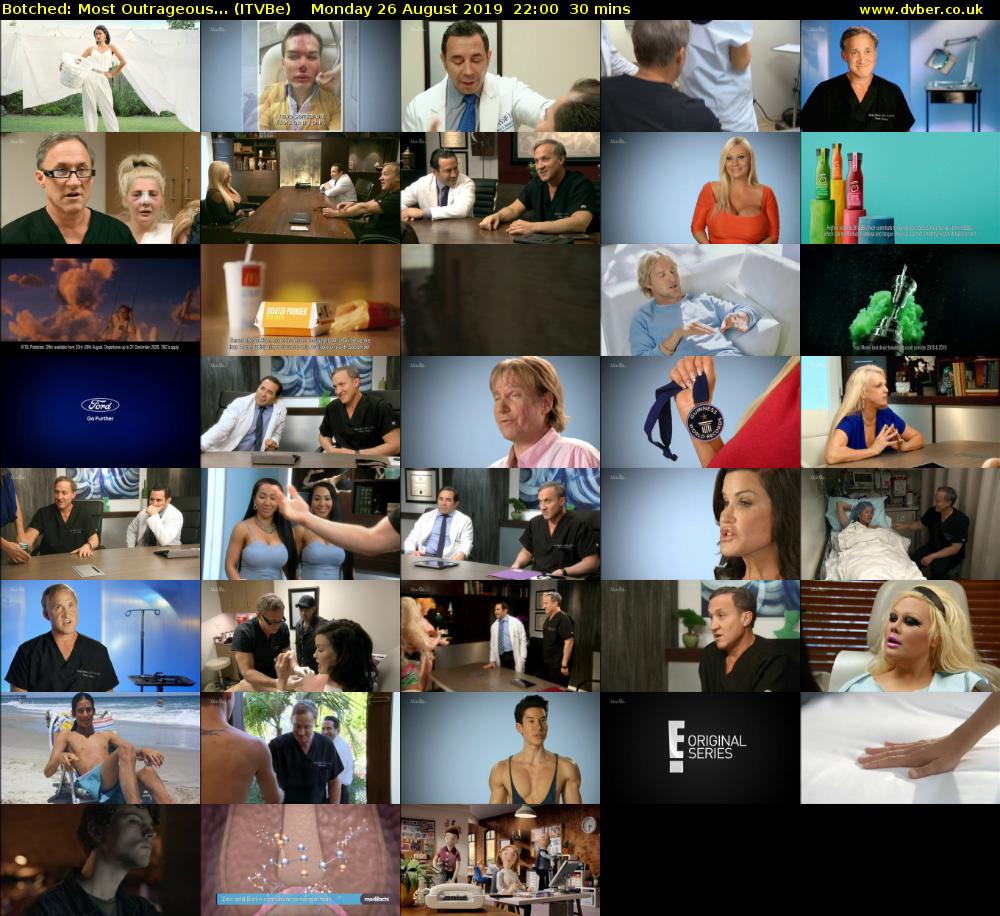 Botched: Most Outrageous... (ITVBe) Monday 26 August 2019 22:00 - 22:30