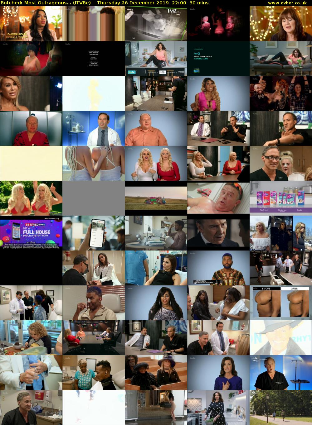 Botched: Most Outrageous... (ITVBe) Thursday 26 December 2019 22:00 - 22:30