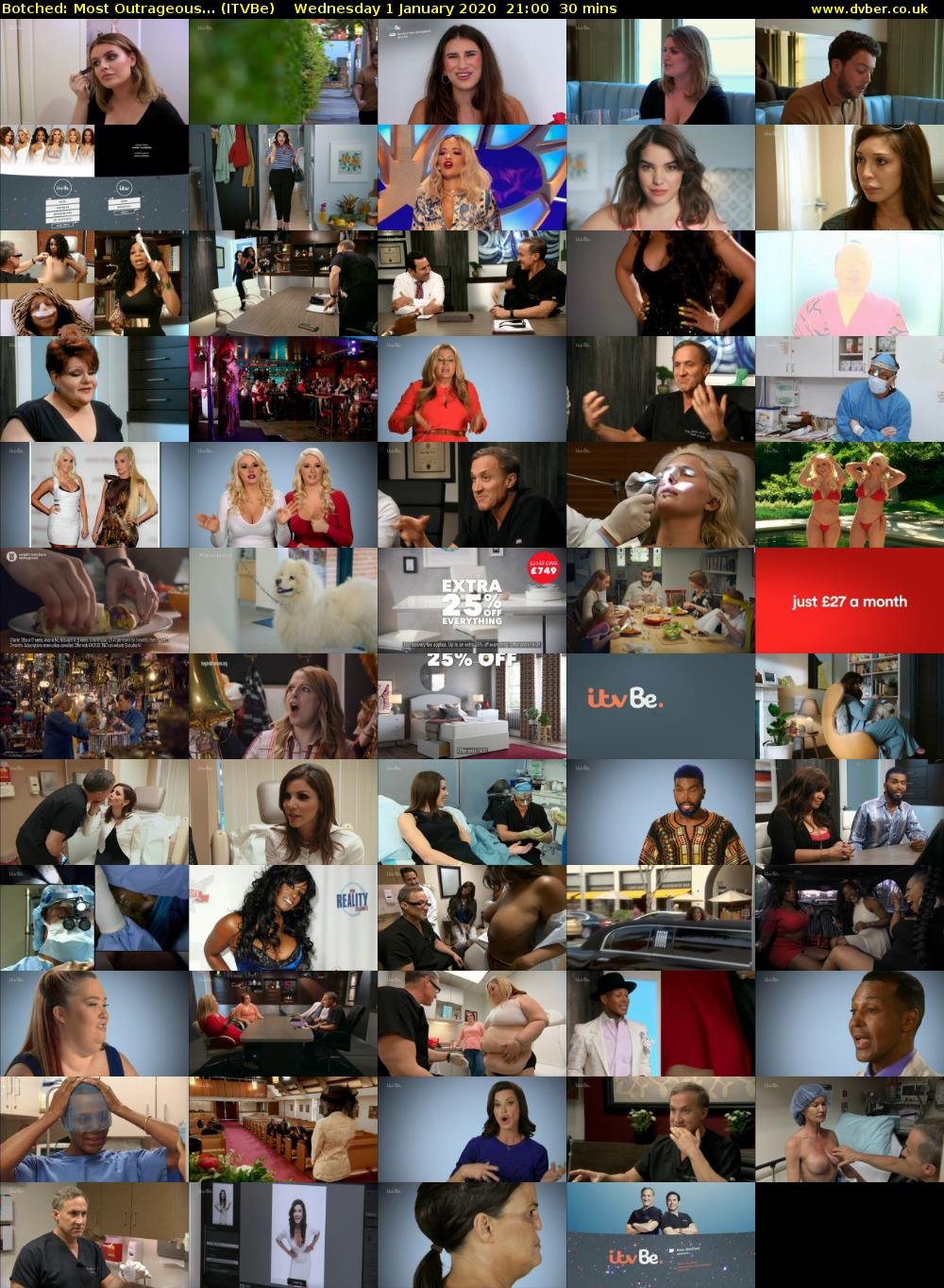 Botched: Most Outrageous... (ITVBe) Wednesday 1 January 2020 21:00 - 21:30