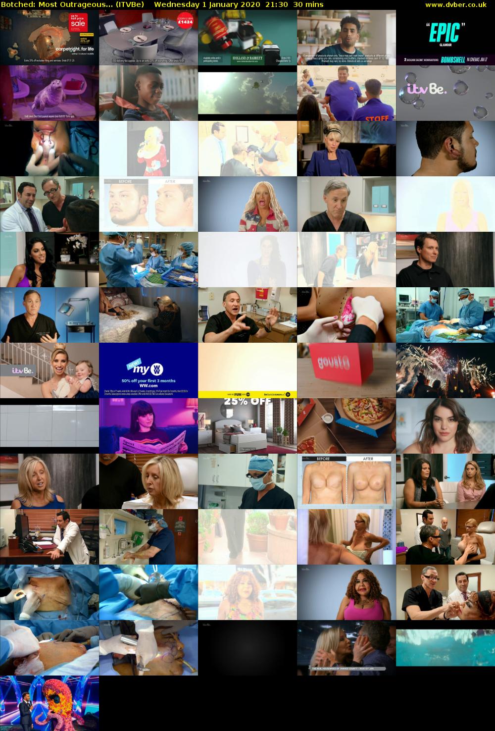 Botched: Most Outrageous... (ITVBe) Wednesday 1 January 2020 21:30 - 22:00
