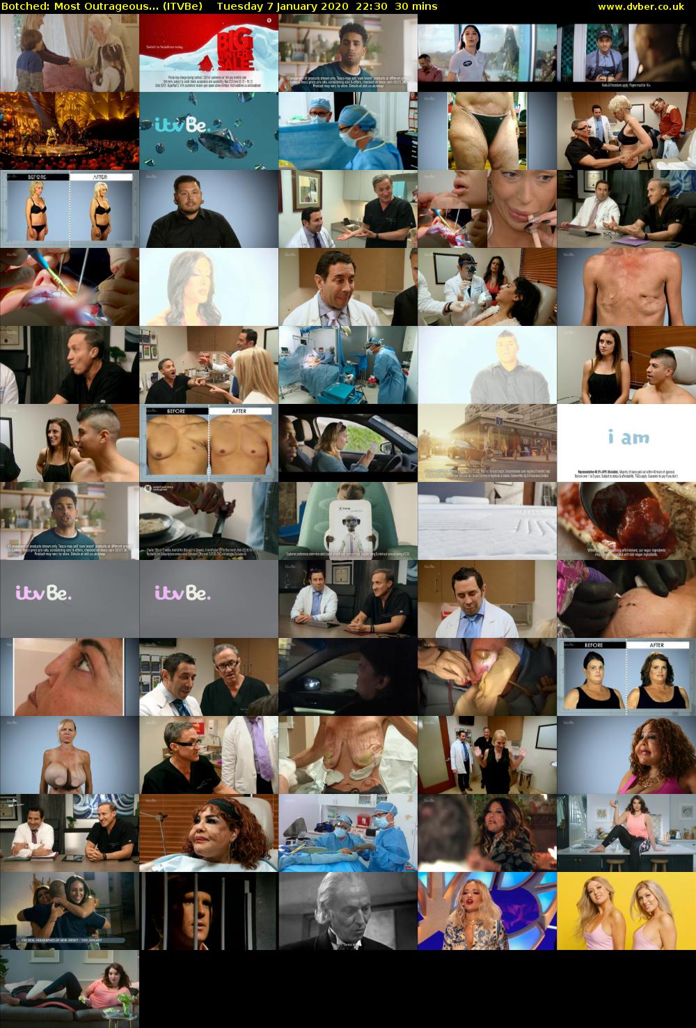 Botched: Most Outrageous... (ITVBe) Tuesday 7 January 2020 22:30 - 23:00