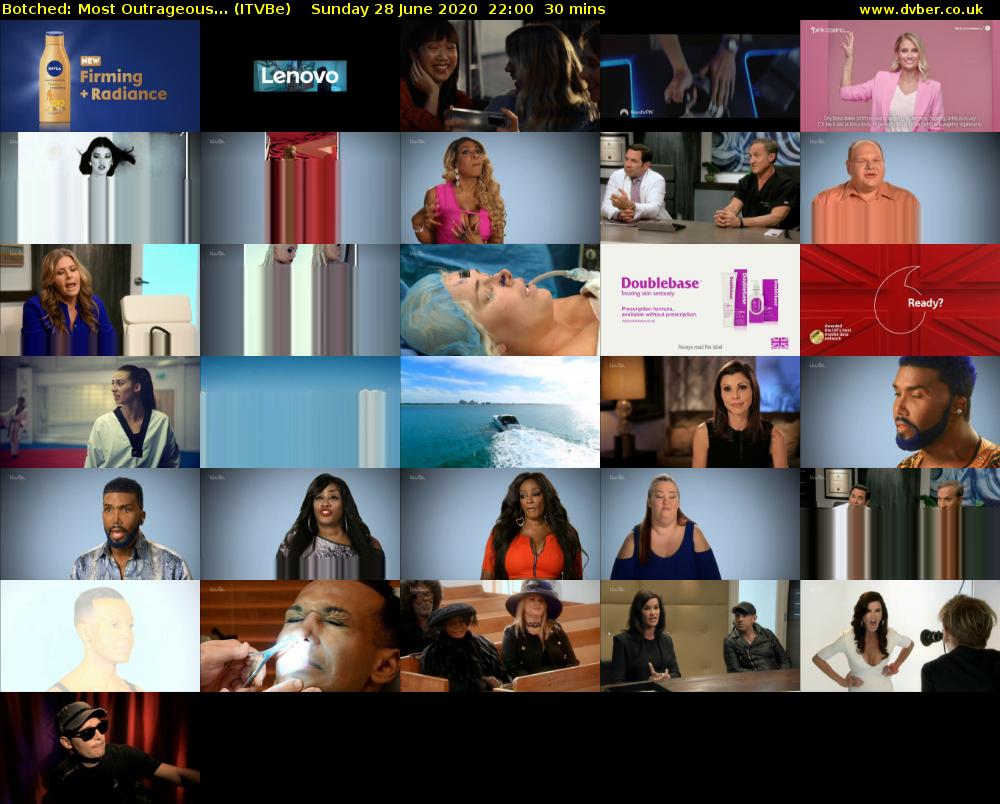Botched: Most Outrageous... (ITVBe) Sunday 28 June 2020 22:00 - 22:30
