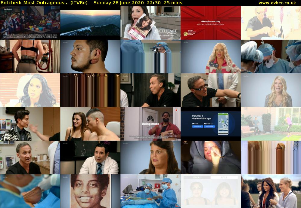 Botched: Most Outrageous... (ITVBe) Sunday 28 June 2020 22:30 - 22:55