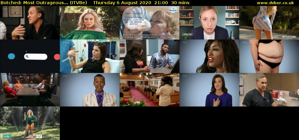 Botched: Most Outrageous... (ITVBe) Thursday 6 August 2020 21:00 - 21:30