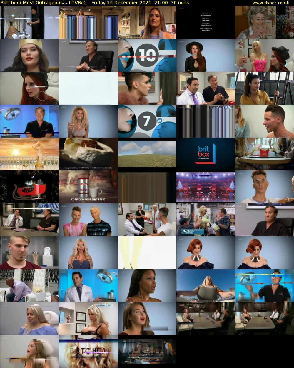Botched: Most Outrageous... (ITVBe) Friday 24 December 2021 21:00 - 21:30