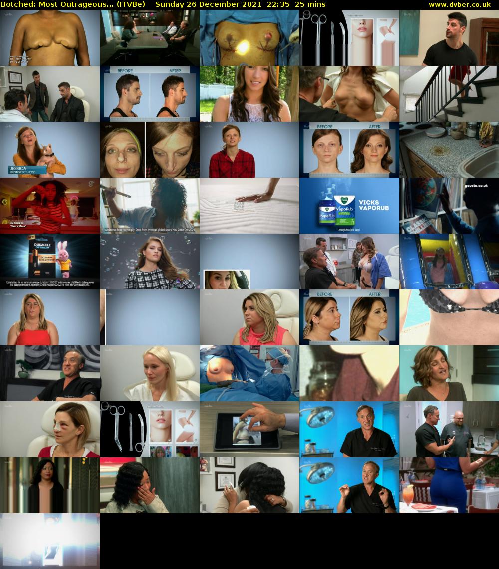 Botched: Most Outrageous... (ITVBe) Sunday 26 December 2021 22:35 - 23:00