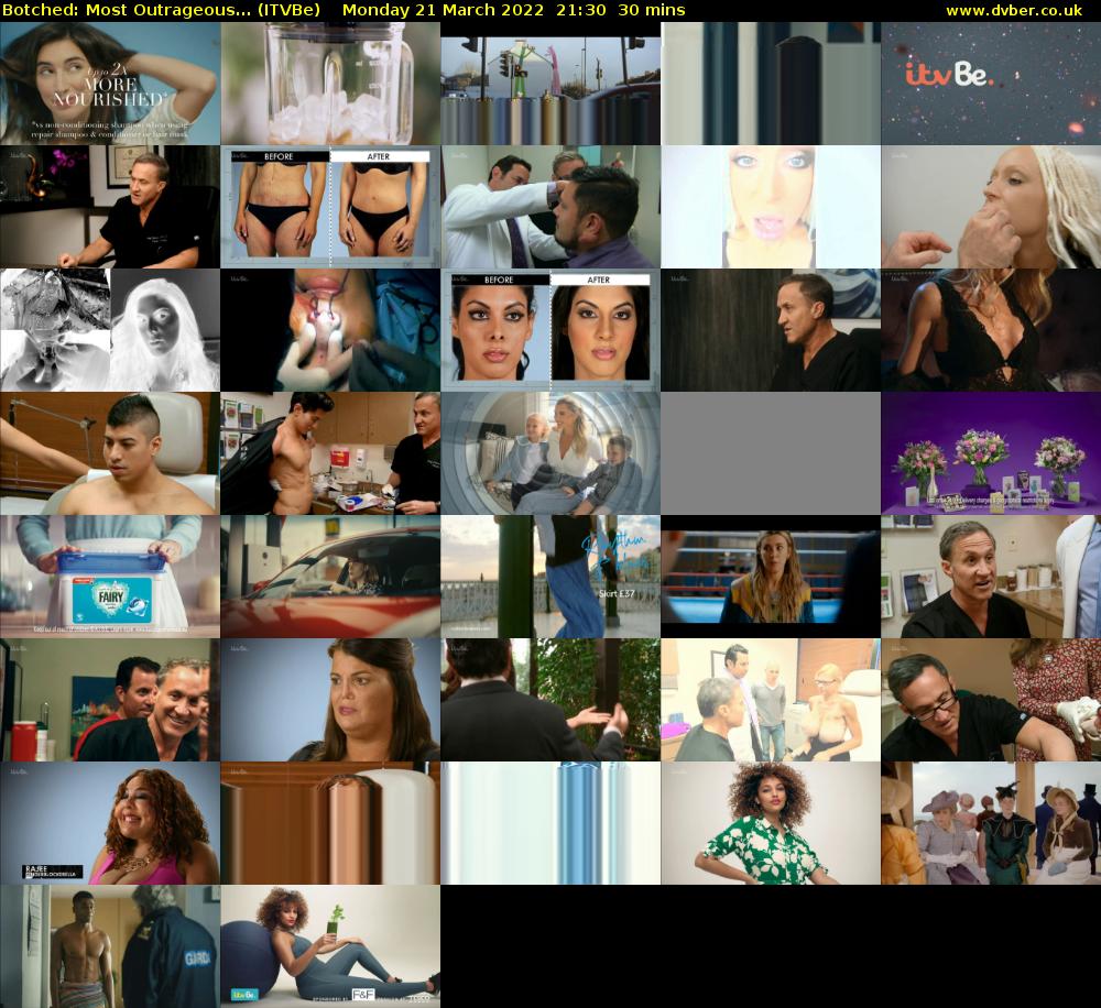 Botched: Most Outrageous... (ITVBe) Monday 21 March 2022 21:30 - 22:00