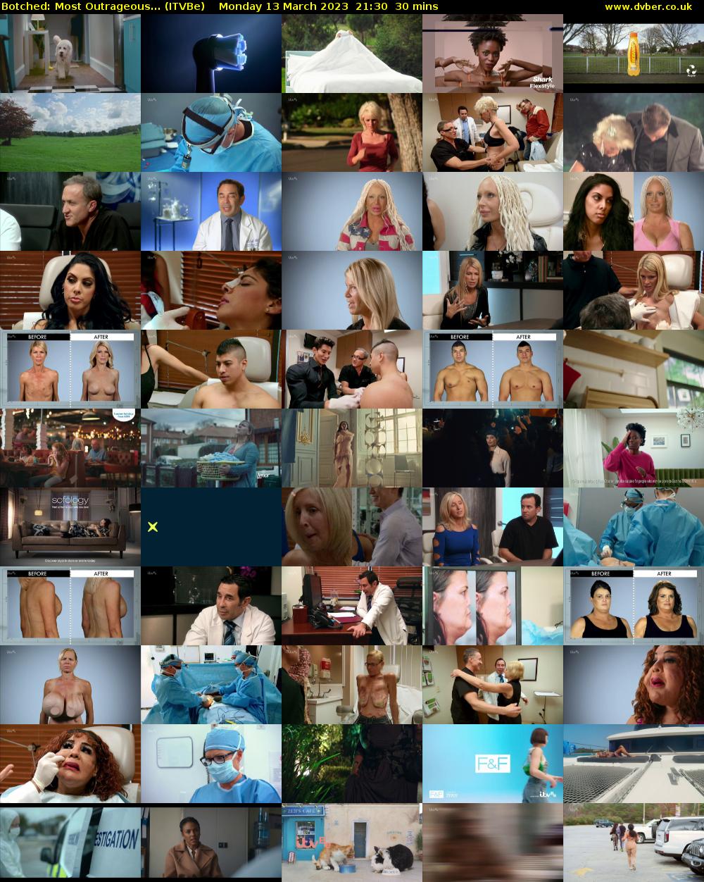 Botched: Most Outrageous... (ITVBe) Monday 13 March 2023 21:30 - 22:00