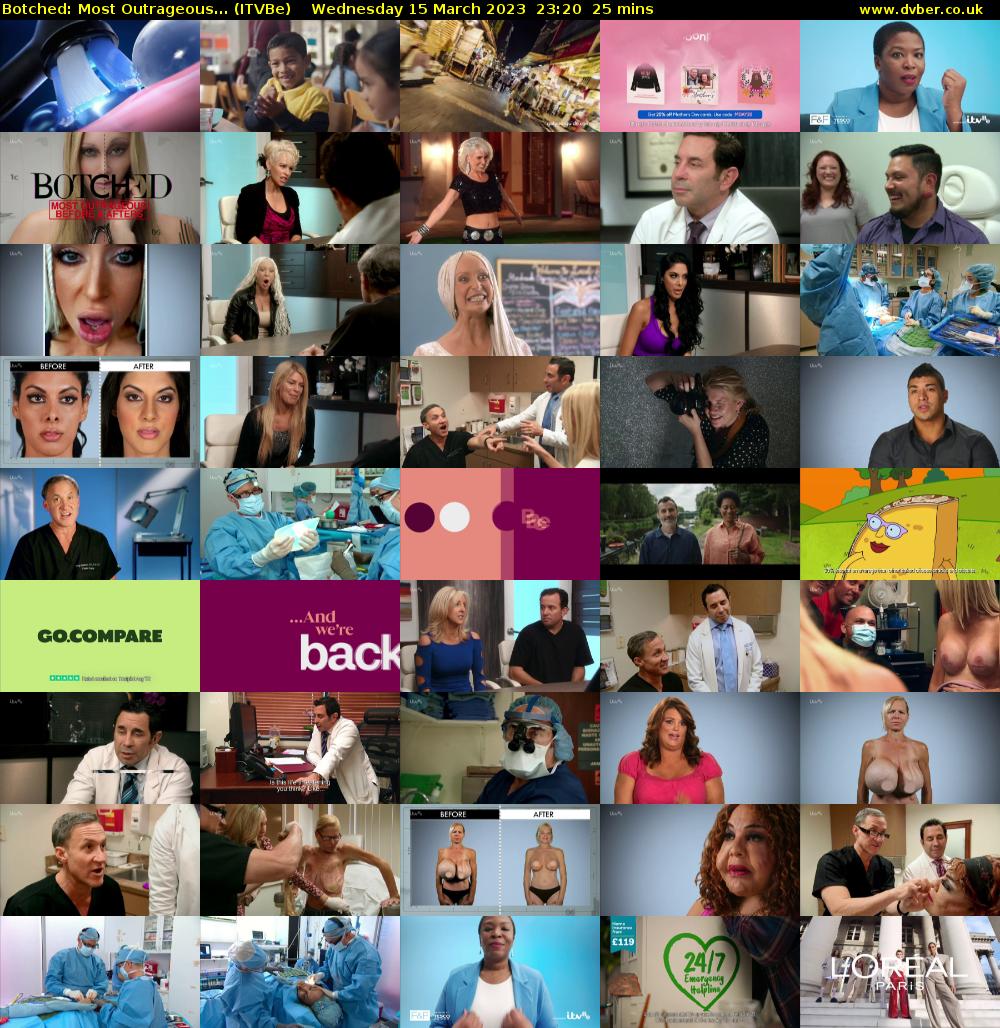 Botched: Most Outrageous... (ITVBe) Wednesday 15 March 2023 23:20 - 23:45