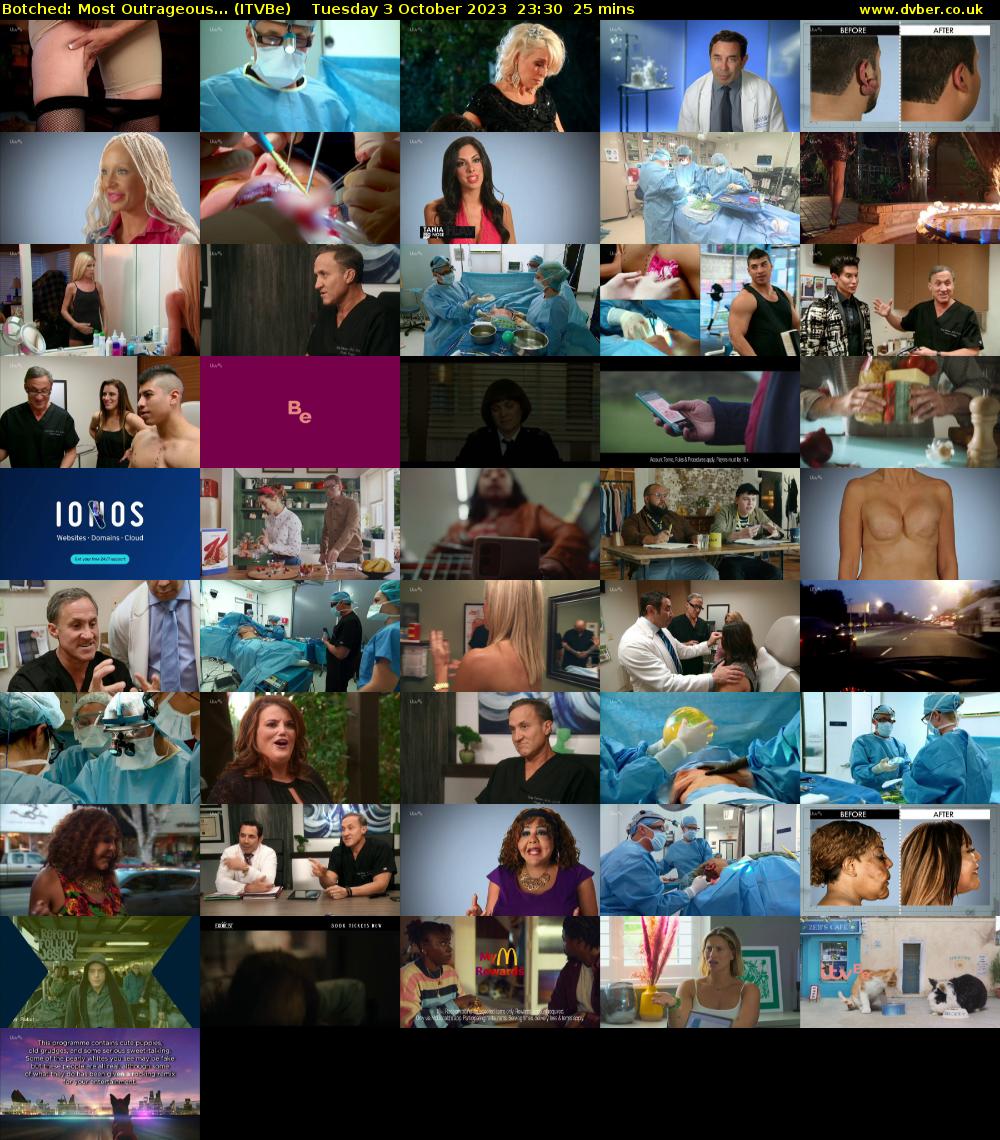 Botched: Most Outrageous... (ITVBe) Tuesday 3 October 2023 23:30 - 23:55