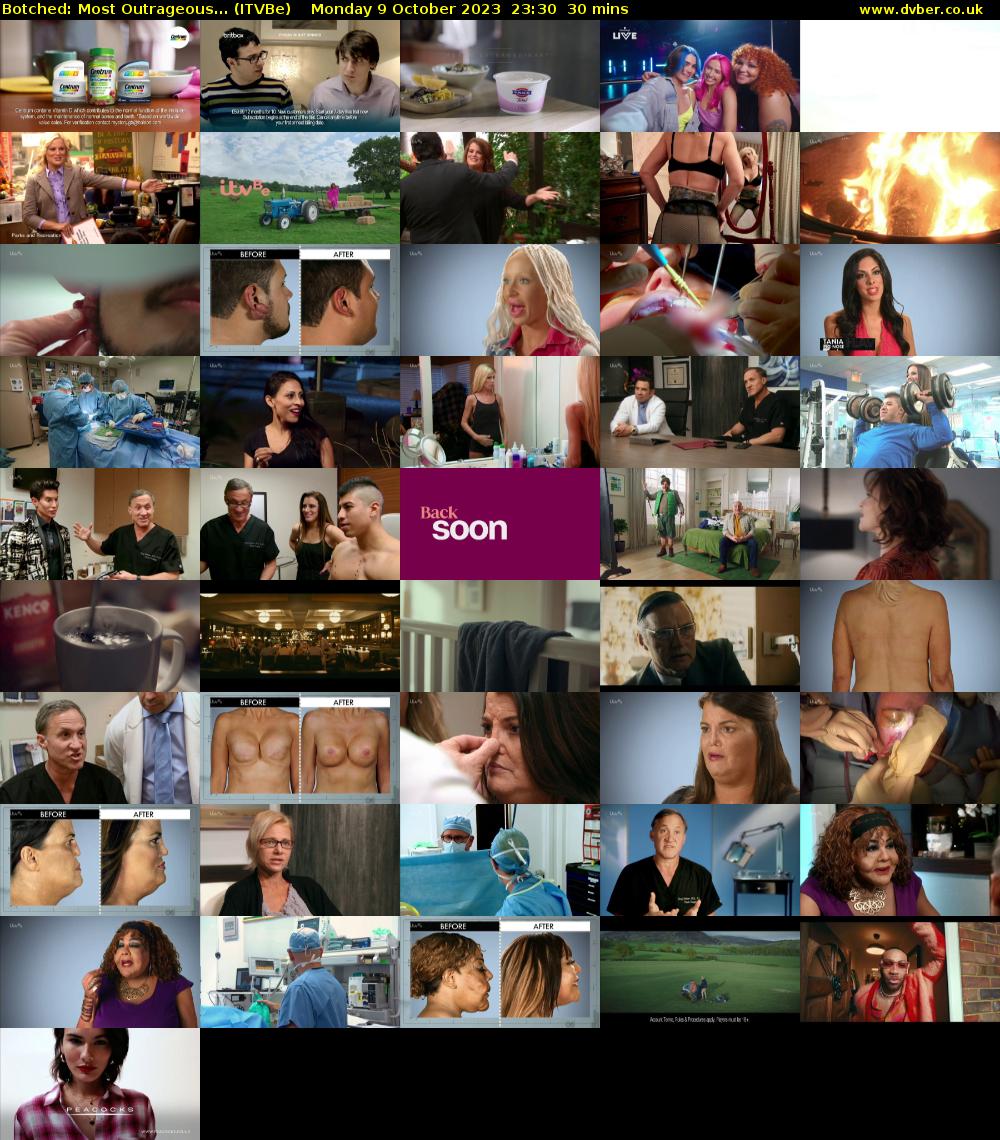 Botched: Most Outrageous... (ITVBe) Monday 9 October 2023 23:30 - 00:00