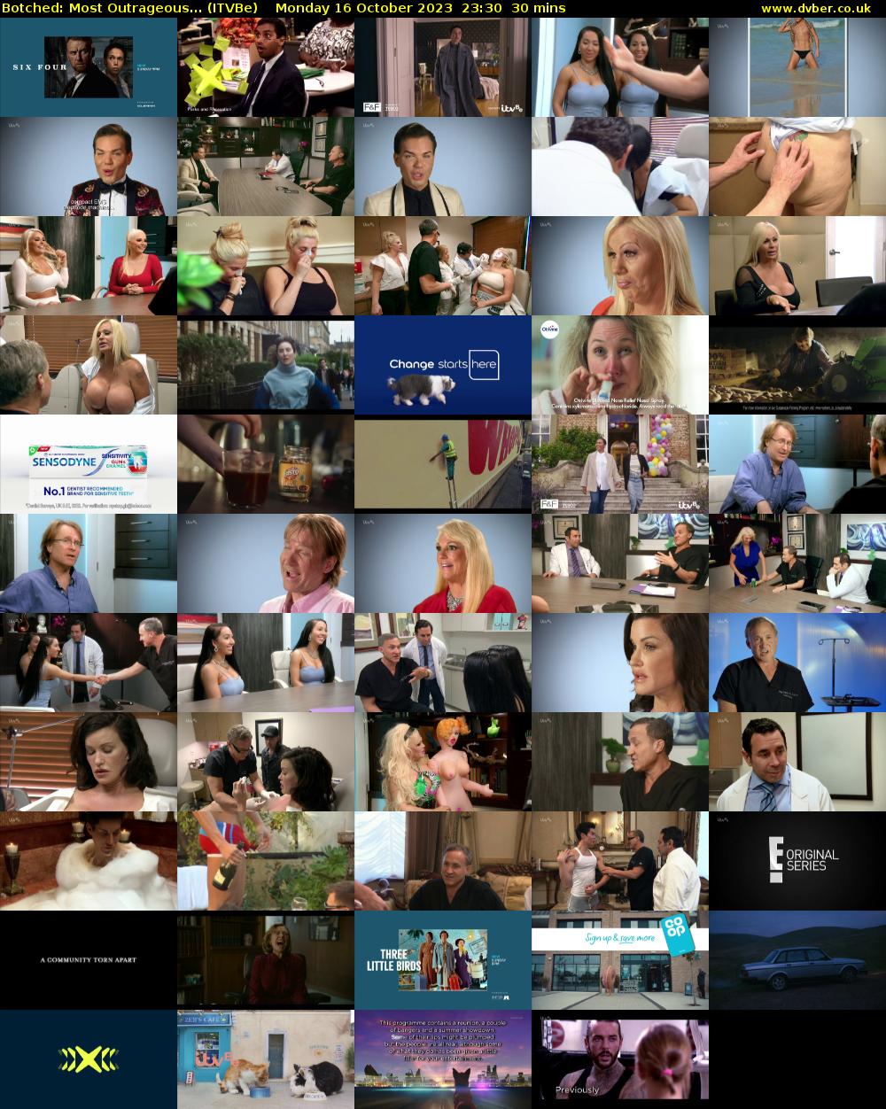 Botched: Most Outrageous... (ITVBe) Monday 16 October 2023 23:30 - 00:00