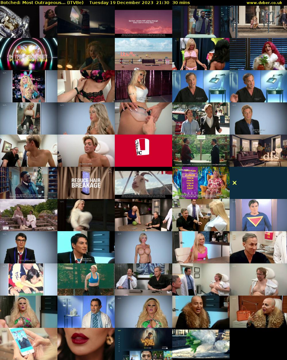 Botched: Most Outrageous... (ITVBe) Tuesday 19 December 2023 21:30 - 22:00