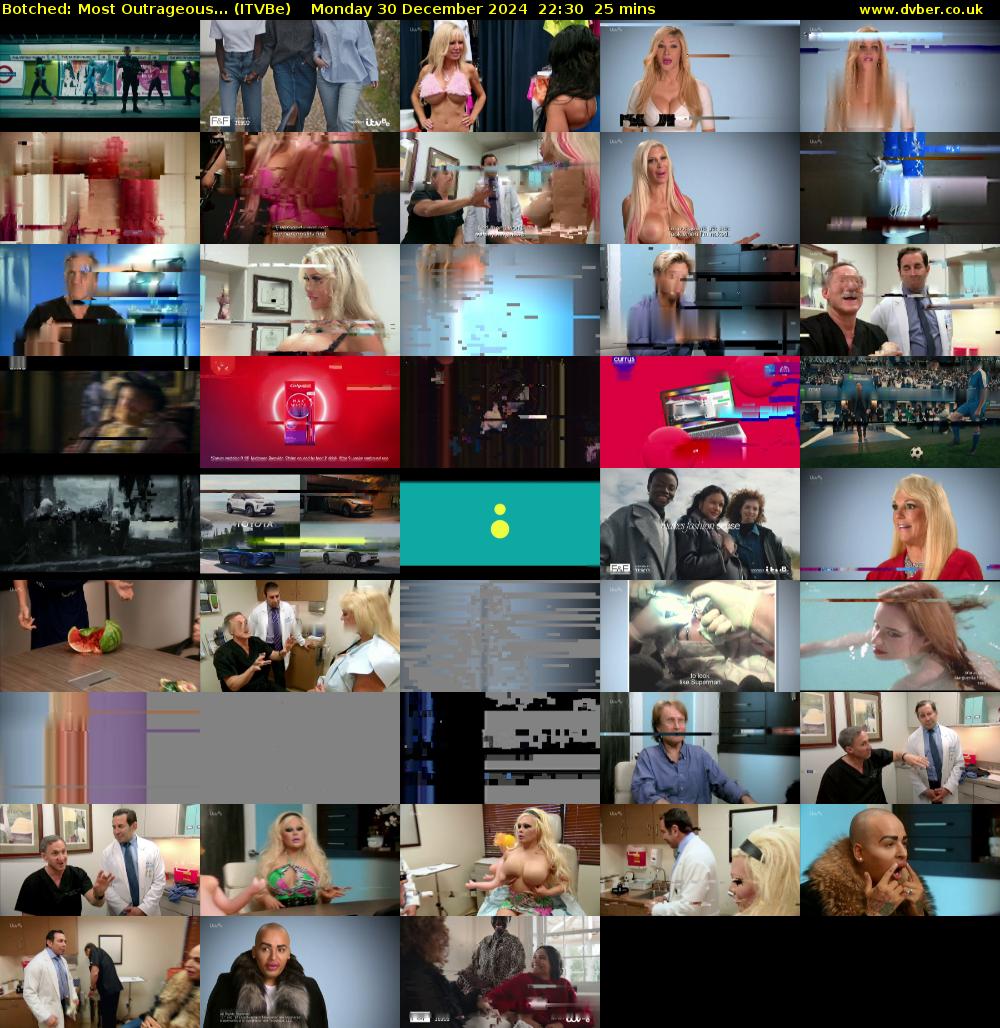 Botched: Most Outrageous... (ITVBe) Monday 30 December 2024 22:30 - 22:55