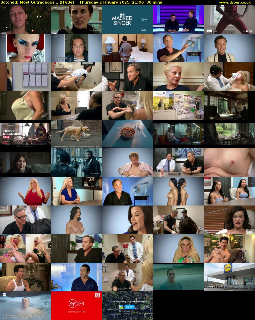 Botched: Most Outrageous... (ITVBe) Thursday 2 January 2025 21:00 - 21:30