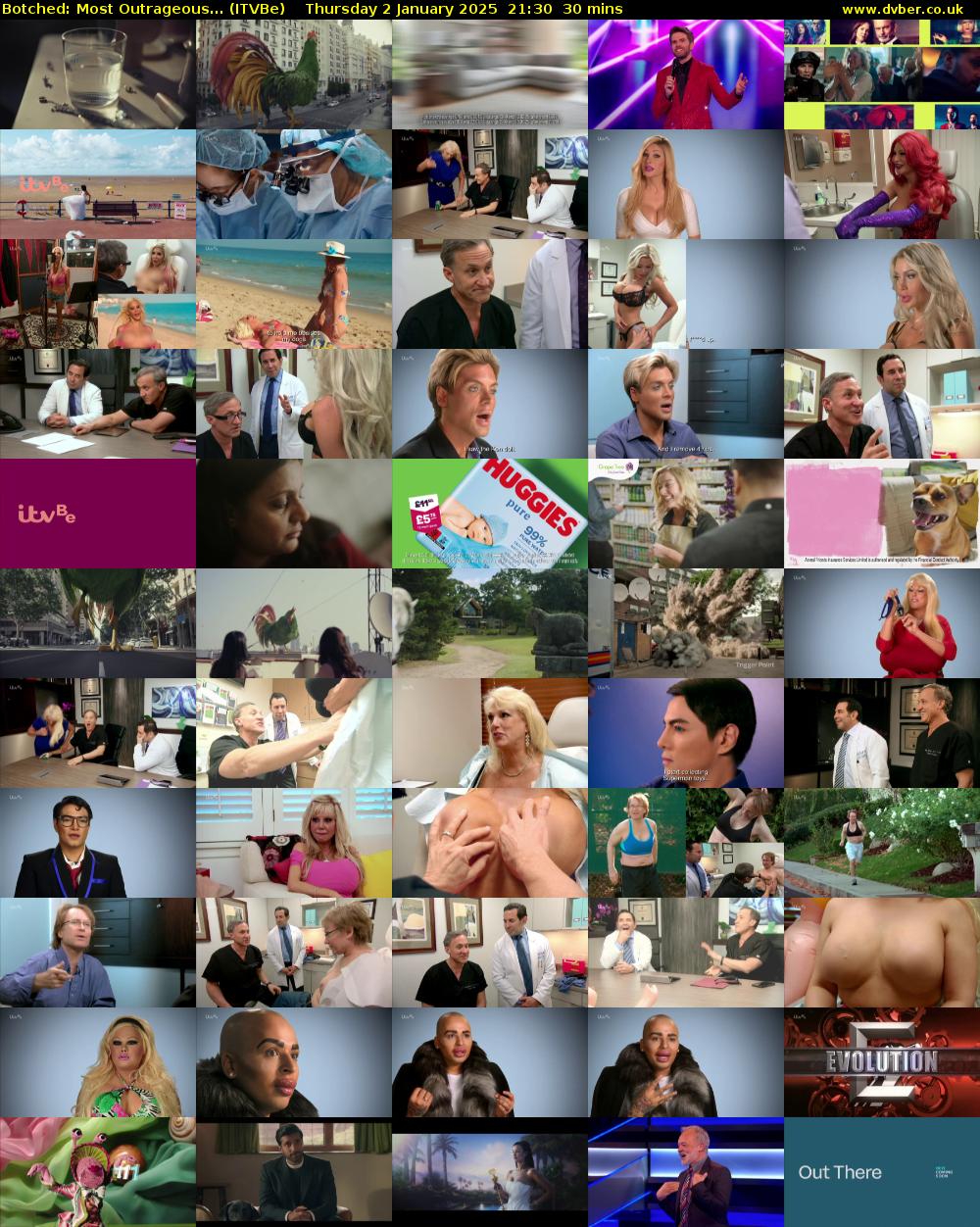 Botched: Most Outrageous... (ITVBe) Thursday 2 January 2025 21:30 - 22:00