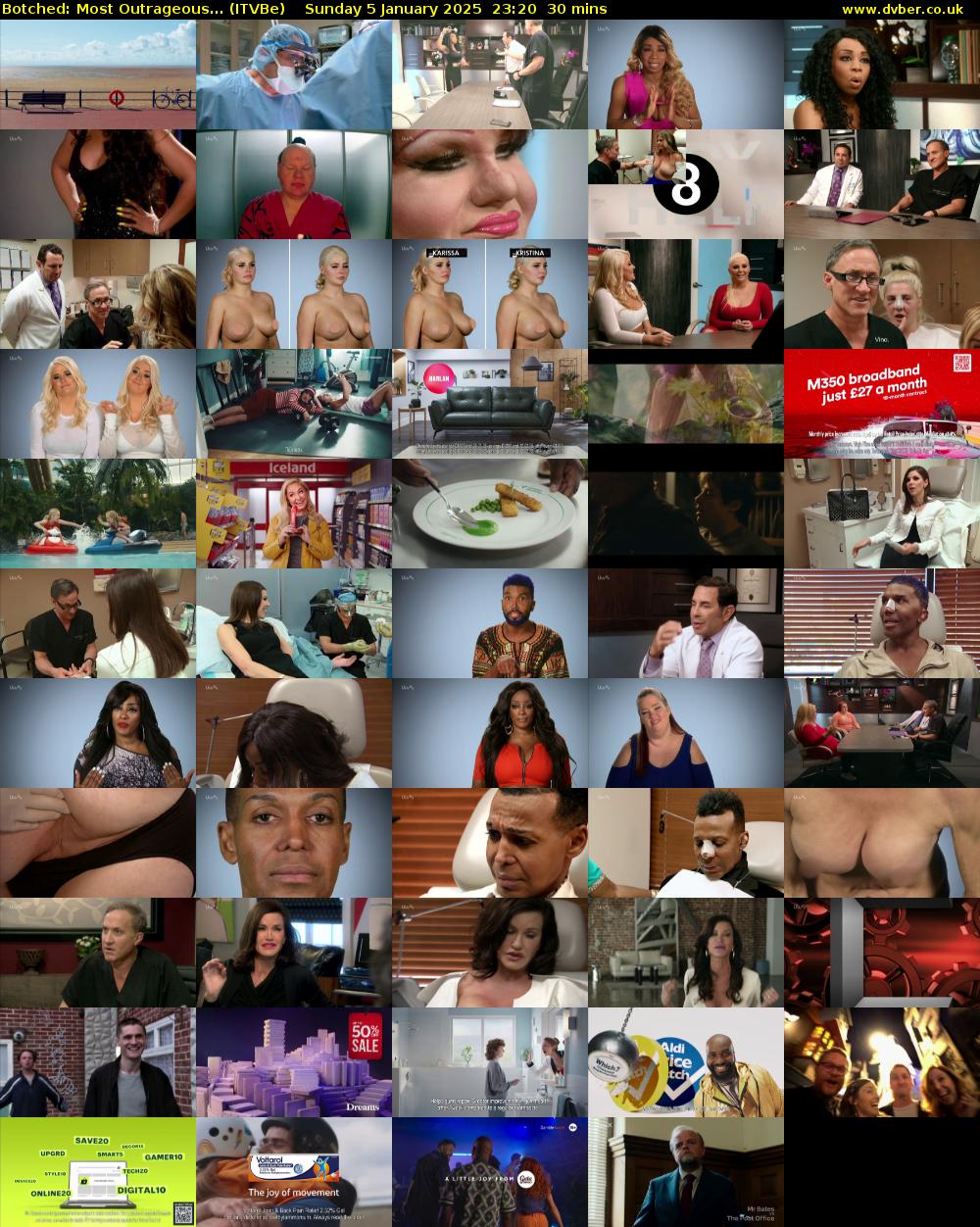 Botched: Most Outrageous... (ITVBe) Sunday 5 January 2025 23:20 - 23:50