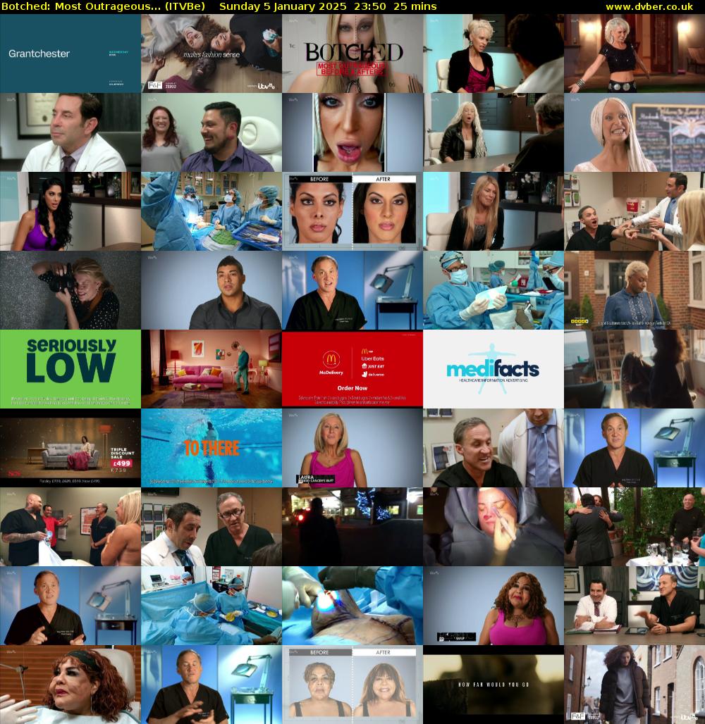 Botched: Most Outrageous... (ITVBe) Sunday 5 January 2025 23:50 - 00:15