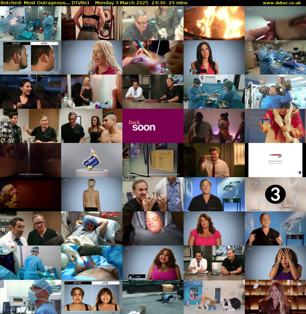 Botched: Most Outrageous... (ITVBe) Monday 3 March 2025 23:30 - 23:55